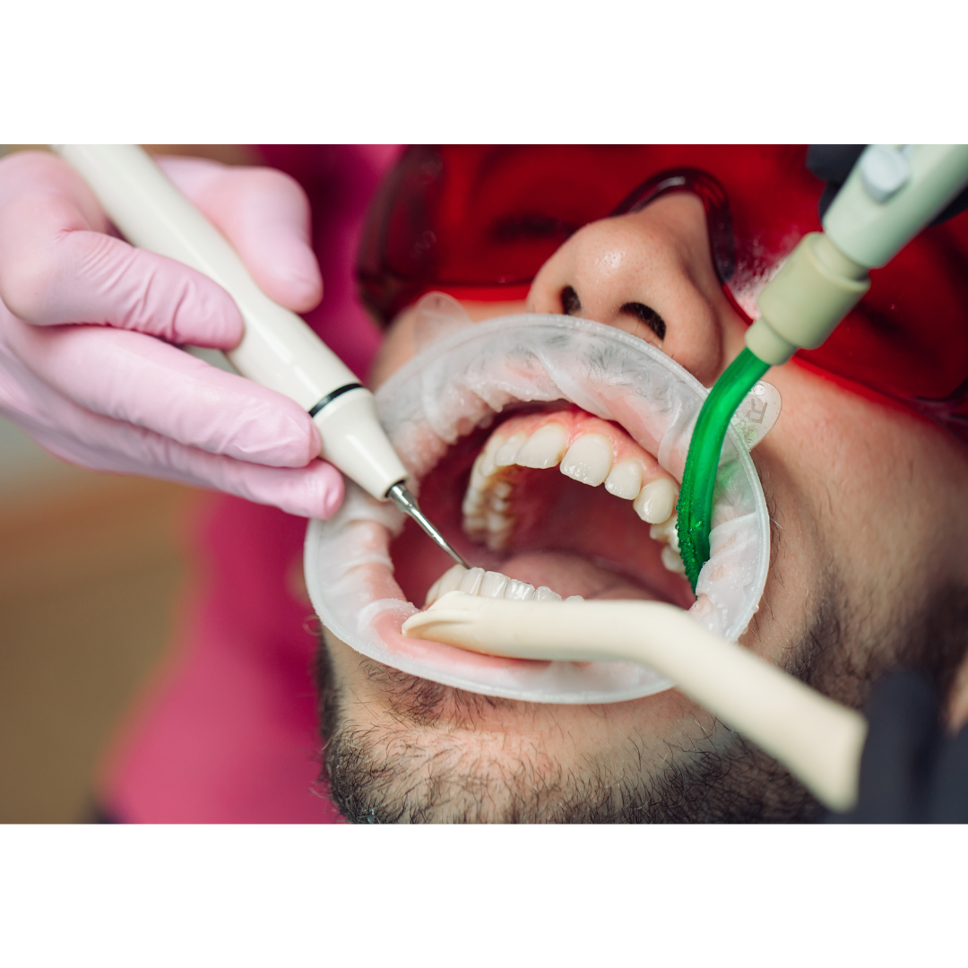 How to protect your teeth from Cavities and other dental problems